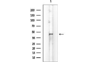 Western blot analysis of lysates from COLO205 cells(heat-shock treatment), using CD79B Mouse Monoclonal Antibody at 1/1000 dilution.