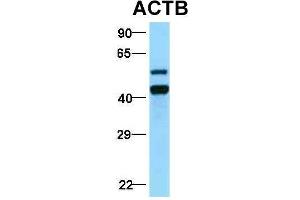 Western Blotting (WB) image for anti-Actin, beta (ACTB) (Middle Region) antibody (ABIN2778644)