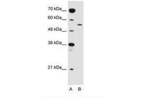 Image no. 1 for anti-Solute Carrier Family 2 (Facilitated Glucose Transporter), Member 10 (SLC2A10) (AA 371-420) antibody (ABIN205022)