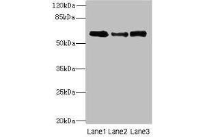 Western blot All lanes: Smox antibody at 3 μg/mL Lane 1: PC-3 whole cell lysate Lane 2: A549 whole cell lysate Lane 3: 293T whole cell lysate Secondary Goat polyclonal to rabbit IgG at 1/10000 dilution Predicted band size: 62, 66, 27, 23, 28, 60, 57, 47, 61, 21 kDa Observed band size: 62 kDa (SMOX 抗体  (AA 1-555))