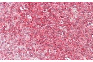 Detection of CAPN1 in Human Tonsil Tissue using Polyclonal Antibody to Calpain 1 (CAPN1) (CAPN1 抗体  (AA 75-343))