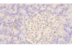 Immunohistochemistry (IHC) image for anti-V-Set Domain Containing T Cell Activation Inhibitor 1 (VTCN1) (AA 34-147) antibody (ABIN7436759)