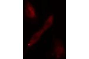 ABIN6275181 staining  293 cells by IF/ICC. (GNL3L 抗体)