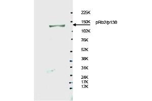 Image no. 1 for anti-Retinoblastoma-Like 2 (p130) (RBL2) antibody (ABIN401457) (p130 抗体)