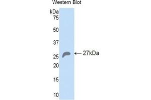 Detection of Recombinant HSPA5, Mouse using Polyclonal Antibody to Heat Shock 70 kDa Protein 5 (HSPA5)