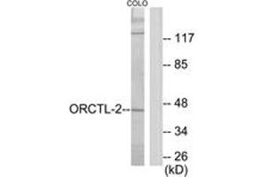Western blot analysis of extracts from COLO205 cells, using ORCTL-2 Antibody. (ORCTL-2/SLC22A18 抗体  (AA 359-408))
