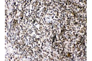 Immunohistochemistry (IHC) image for anti-High Mobility Group Box 2 (HMGB2) (AA 65-97), (N-Term) antibody (ABIN4886620)
