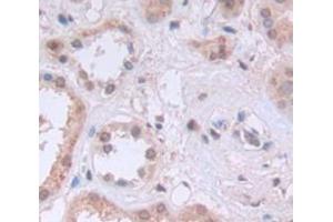 Used in DAB staining on fromalin fixed paraffin- embedded Kidney tissue (KPNB1 抗体  (AA 21-441))