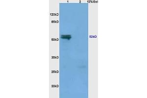 Lane 1: mouse spleen lysates Lane 2: mouse liver lysates probed with Anti MMP-3 Polyclonal Antibody, Unconjugated (ABIN668301) at 1:200 in 4 °C. (MMP3 抗体  (AA 401-477))