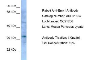 WB Suggested Anti-Emx1 Antibody   Titration: 1.