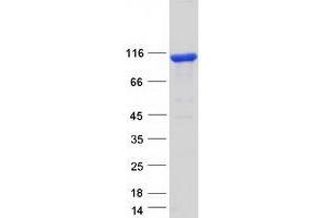 FAM160B1 Protein (Transcript Variant 1) (Myc-DYKDDDDK Tag)