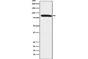 Western blot analysis of Dynein intermediate chain 1 expression in mouse testis lysate.