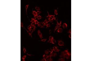 ABIN6268823 staining HuvEc by IF/ICC. (CD69 抗体  (Internal Region))