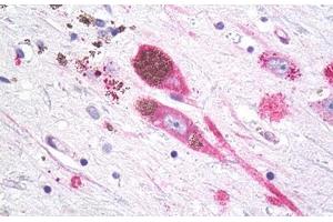 Anti-MC1R antibody IHC staining of brain, substantia nigra, neurons. (MC1 Receptor 抗体  (Cytoplasmic Domain))