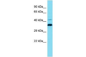 Host: Rabbit Target Name: CCDC137 Sample Type: Jurkat Whole Cell lysates Antibody Dilution: 1. (CCDC137 抗体  (N-Term))