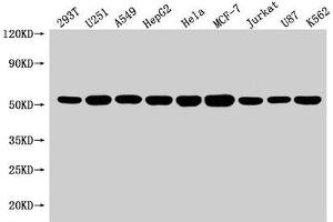 Western Blot Positive WB detected in: 293T whole cell lysate, U251 whole cell lysate, A549 whole cell lysate, HepG2 whole cell lysate, Hela whole cell lysate, MCF-7 whole cell lysate, Jurkat whole cell lysate, U87 whole cell lysate, K562 whole cell lysate All lanes: SLC25A24 antibody at 1:1500 Secondary Goat polyclonal to rabbit IgG at 1/50000 dilution Predicted band size: 54, 52 kDa Observed band size: 54 kDa (SLC25A24 抗体  (AA 1-197))