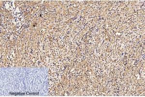 Immunohistochemical analysis of paraffin-embedded mouse kidney tissue. (PARP1 抗体  (Cleaved-Asp214))