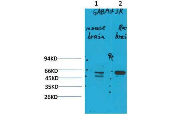 GABRA3 抗体
