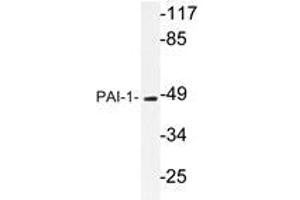 Western blot analysis of PAI-1 Antibody in extracts from Jurkat cells. (PAI1 抗体)