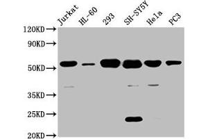 Western Blot Positive WB detected in: Jurkat whole cell lysate, HL60 whole cell lysate, 293 whole cell lysate, SH-SY5Y whole cell lysate, Hela whole cell lysate, PC-3 whole cell lysate All lanes: CYP21A2 antibody at 8 μg/mL Secondary Goat polyclonal to rabbit IgG at 1/50000 dilution Predicted band size: 56, 53 kDa Observed band size: 56 kDa (CYP21A2 抗体  (AA 312-418))