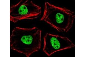 Fluorescent image of HeLa cells stained with TLE1 antibody diluted at 1:25 dilution. (TLE1 抗体  (N-Term))