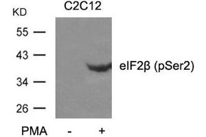 Western blot analysis of extracts from C2C12 cells untreated or treated with PMA using eIF2b(phospho-Ser2) Antibody. (EIF2S2 抗体  (pSer2))