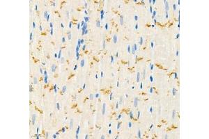 Immunohistochemistry (Paraffin-embedded Sections) (IHC (p)) image for anti-threonine Synthase-Like 2 (THNSL2) antibody (ABIN7075893)