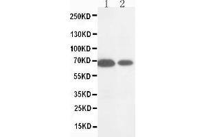 Anti-MMP16 antibody, Western blotting Lane 1: HELA Cell Lysate Lane 2: COLO320 Cell Lysate (MMP16 抗体  (C-Term))