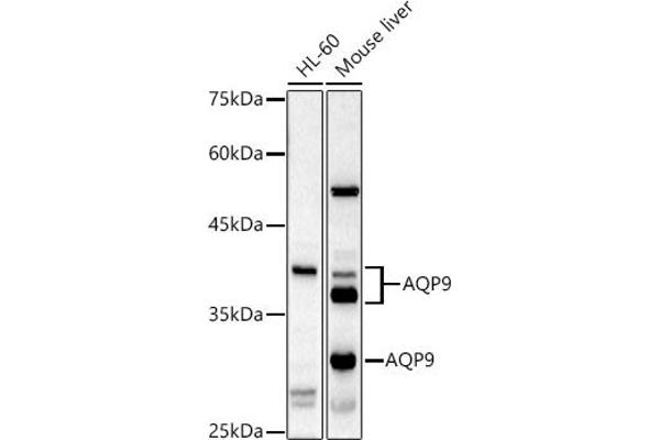 AQP9 Antikörper  (AA 50-150)