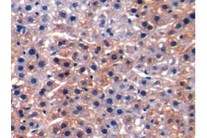 DAB staining on IHC-P; Samples: Rat Liver Tissue (ALT 抗体  (AA 203-443))