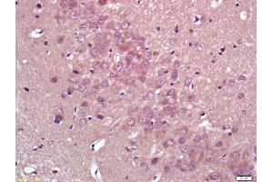 Formalin-fixed and paraffin embedded rat brain labeled with Anti-HMGCR Polyclonal Antibody, Unconjugated (ABIN709196) at 1:200 followed by conjugation to the secondary antibody and DAB staining (HMGCR 抗体  (AA 251-350))