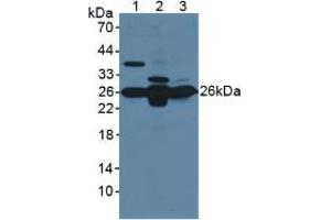 Western blot analysis of (1) Mouse Brain Tissue, (2) Mouse Liver Tissue and (3) Mouse Kidney Tissue. (GSTM1 抗体  (AA 1-218))