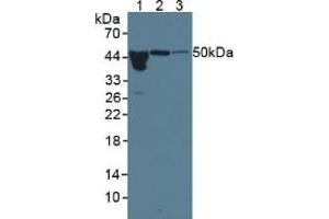 Western blot analysis of (1) Human Serum, (2) Rat Pancreas Tissue and (3) Rat Bladder Tissue. (ORM1 抗体  (AA 19-201))