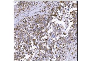IHC analysis of LRP1B using anti-LRP1B antibody (ABIN7601521). (LRP1B 抗体  (AA 3704-4547))