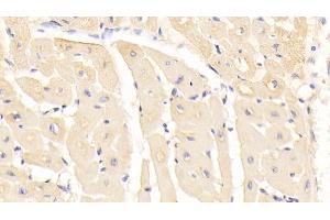 Detection of RARS in Human Cardiac Muscle Tissue using Monoclonal Antibody to Arginyl tRNA Synthetase (RARS) (RARS 抗体  (AA 1-146))
