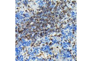 Immunohistochemistry of paraffin-embedded rat spleen using PIK3CG Rabbit pAb (ABIN6130600, ABIN6145638, ABIN6145639 and ABIN6222396) at dilution of 1:100 (40x lens). (PIK3 gamma 抗体  (AA 1-200))