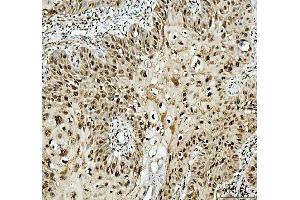 IHC analysis of SFPQ using anti-SFPQ antibody (ABIN7603089). (SFPQ 抗体  (Middle Region))
