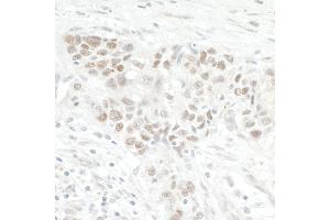 anti-Nucleolar Protein 12 (NOL12) (AA 163-213) antibody