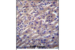 SCP2 Antibody (N-term) (ABIN656448 and ABIN2845733) immunohistochemistry analysis in formalin fixed and paraffin embedded human liver tissue followed by peroxidase conjugation of the secondary antibody and DAB staining. (SCP2 抗体  (N-Term))