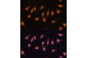 Immunofluorescence (IF) image for anti-Myogenic Differentiation 1 (MYOD1) (AA 150-250) antibody (ABIN1513236)