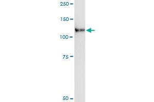 Immunoprecipitation of LLGL2 transfected lysate using anti-LLGL2 MaxPab rabbit polyclonal antibody and Protein A Magnetic Bead , and immunoblotted with LLGL2 purified MaxPab mouse polyclonal antibody (B01P) . (LLGL2 抗体  (AA 1-1020))