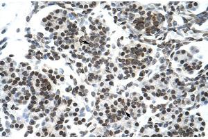 Rabbit Anti-ZNF394 Antibody Catalog Number: ARP30072 Paraffin Embedded Tissue: Human Pancreas Cellular Data: Epithelial cells of pancreatic acinus Antibody Concentration: 4. (ZNF394 抗体  (N-Term))