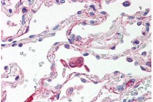 Human Lung, Alveolar Macrophages (formalin-fixed, paraffin-embedded) stained with TLR6 antibody ABIN214529 at 5 ug/ml followed by biotinylated goat anti-rabbit IgG secondary antibody ABIN481713, alkaline phosphatase-streptavidin and chromogen. (TLR6 抗体  (Internal Region))