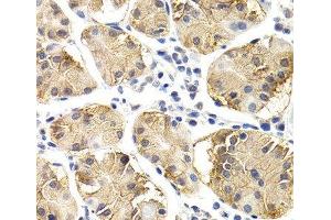 Immunohistochemistry of paraffin-embedded Human normal stomach using CHIT1 Polyclonal Antibody at dilution of 1:200 (40x lens). (Chitotriosidase 1 抗体)