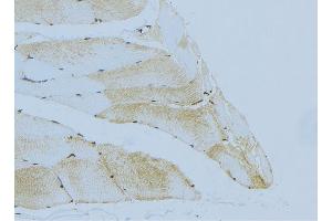 ABIN6276446 at 1/100 staining Mouse muscle tissue by IHC-P. (Hexokinase 2 抗体  (C-Term))