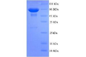 SDS-PAGE (SDS) image for Protein tyrosine Phosphatase, Receptor Type, C (PTPRC) (AA 24-575) protein (His tag) (ABIN5713770) (CD45 Protein (AA 24-575) (His tag))
