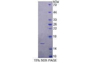 SDS-PAGE analysis of Human FABP4 Protein. (FABP4 蛋白)
