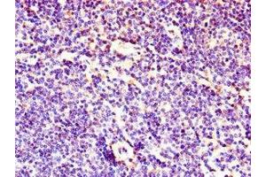 Immunohistochemistry of paraffin-embedded human lymph node tissue using ABIN7158656 at dilution of 1:100 (LEF1 抗体  (AA 75-216))
