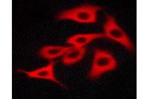 Immunofluorescence (fixed cells) (IF/ICC) image for anti-Mast/stem Cell Growth Factor Receptor (KIT) (pTyr703) antibody (ABIN6255994)