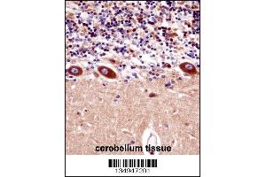 Immunohistochemistry (IHC) image for anti-Potassium Voltage-Gated Channel, Shaker-Related Subfamily, Member 1 (KCNA1) (AA 172-201) antibody (ABIN5536325)
